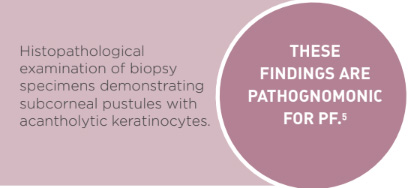 Box1 ciclosporine,sole agent.jpg